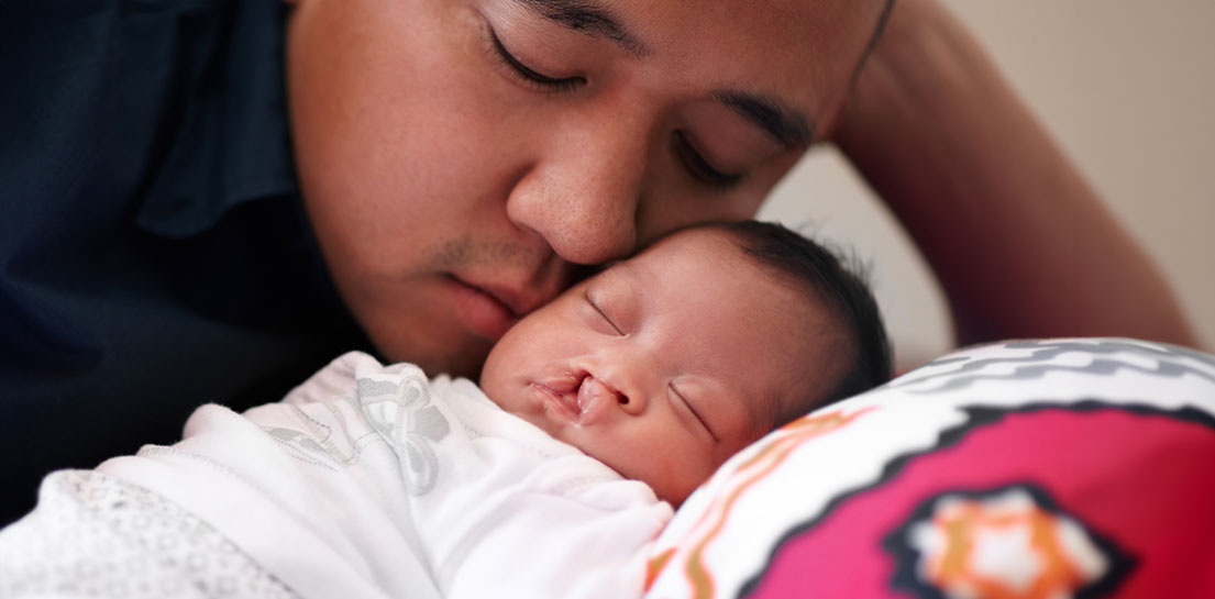 Father tenderly kisses his sleeping baby with a cleft lip